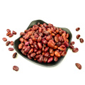 ethiopian red kidney beans